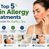 Skin Allergy Treatment in Delhi