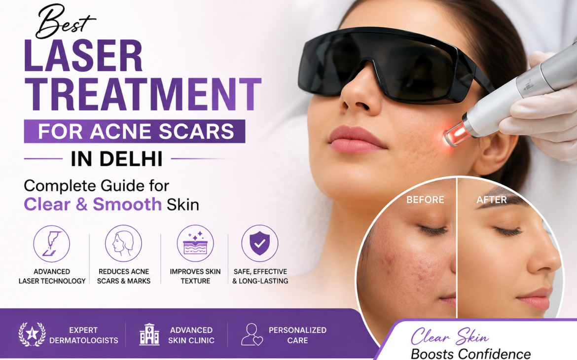 Laser Treatment