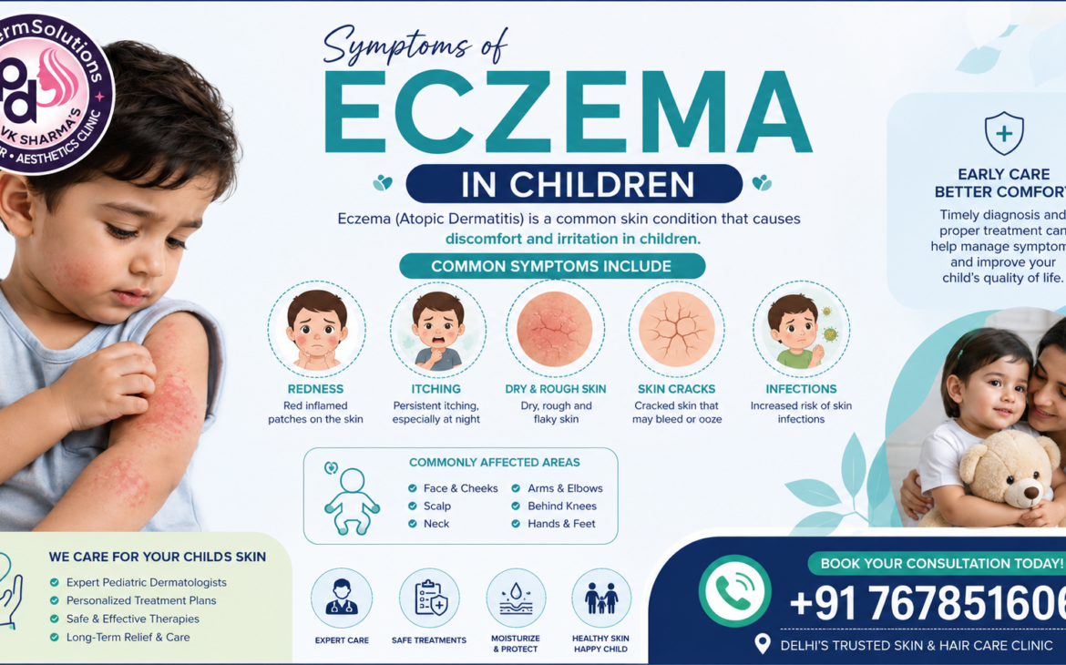 Eczema Treatment in Delhi