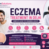Eczema Treatment in Delhi