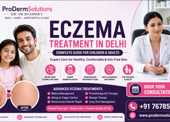 Eczema Treatment in Delhi