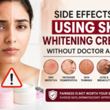 Pigmentation Treatment Delhi