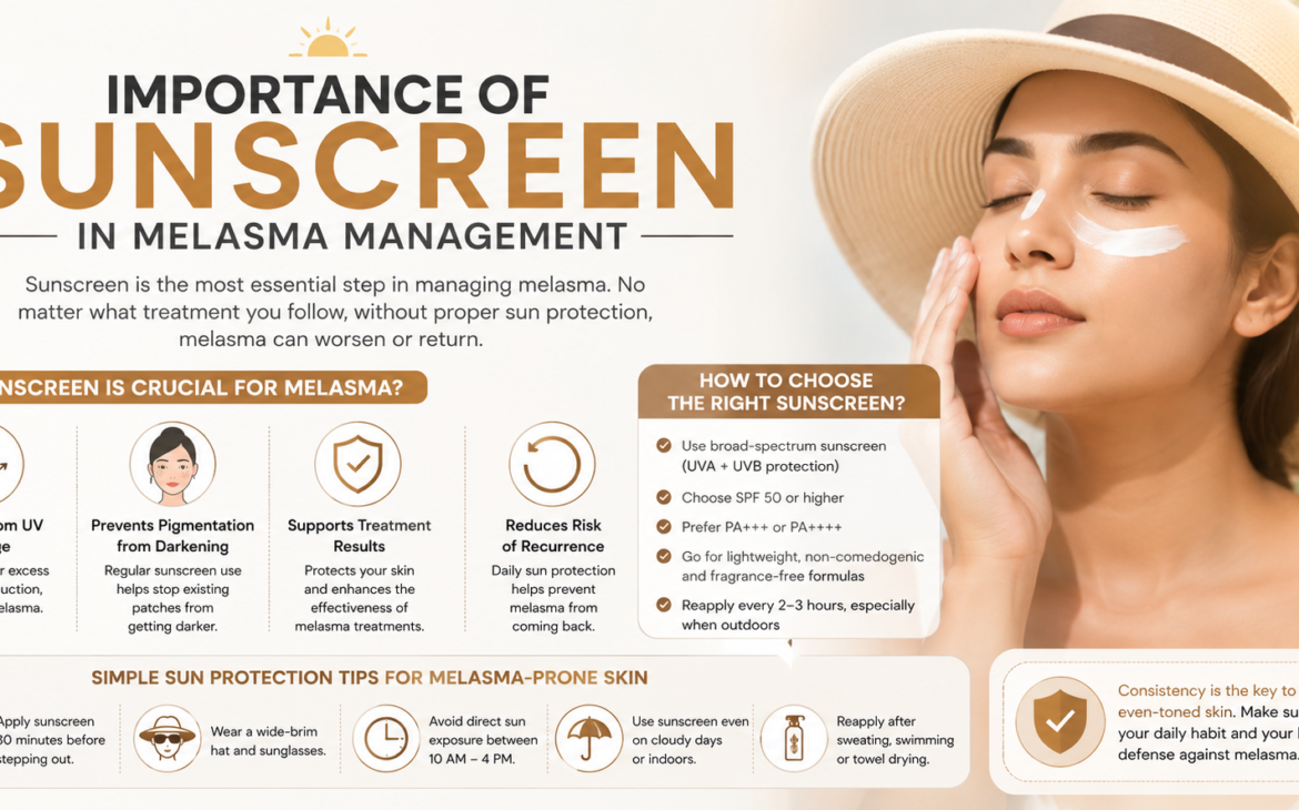 Melasma