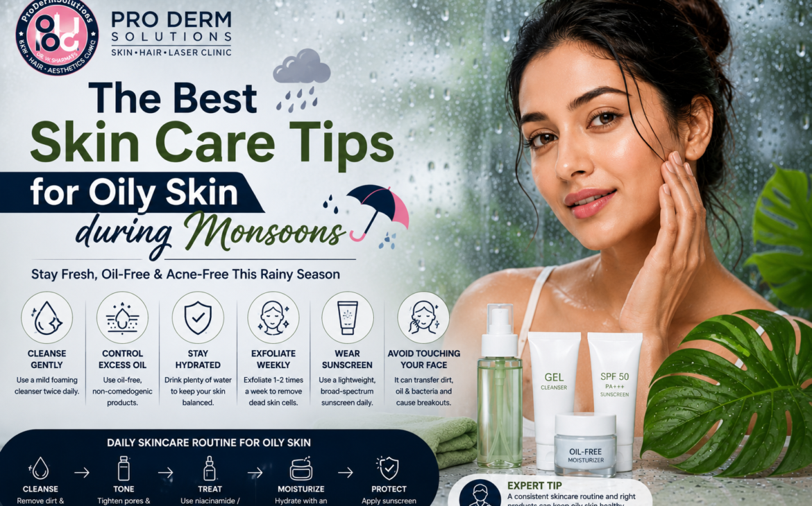 Monsoon Skin Care Tips for Oily Skin