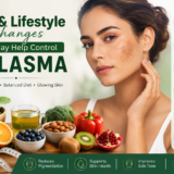 Melasma Treatment in Delhi