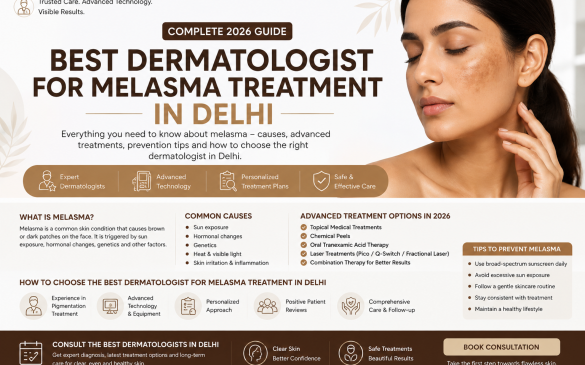Melasma