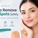 Dark Spots