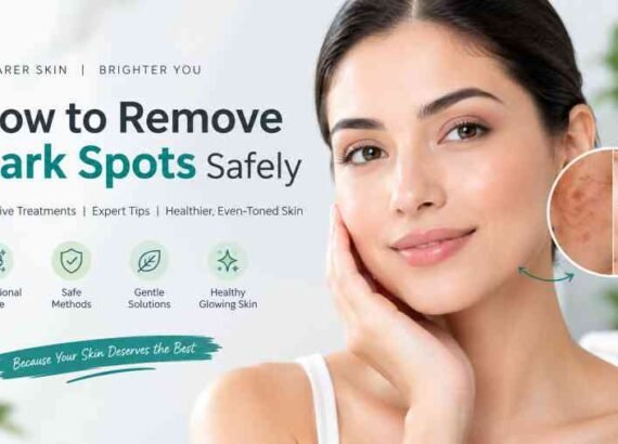 Dark Spots